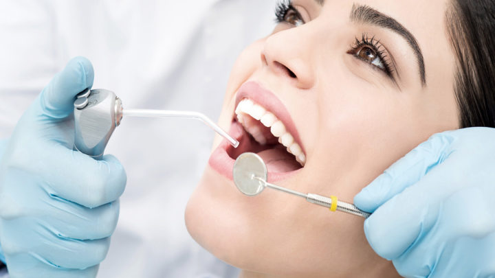 Wybielamy zęby – na jakie rozwiązanie się zdecydować?